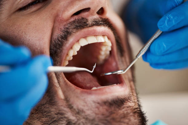 Best Dental Fillings (Composite and Amalgam)  in Big Lake, WA